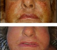 LaserWise Skin & Beauty Clinic image 9